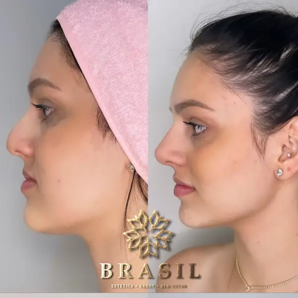 BRASIL ESTÉTICA Saúde e Bem estar! DR TATIANE R. BRASIL - Anunciante do Grude.digital